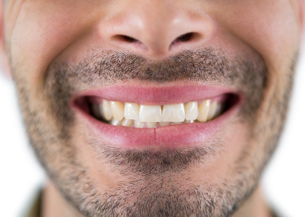 Negydomi ir neprižiūrėti dantys - pavojus sveikatai