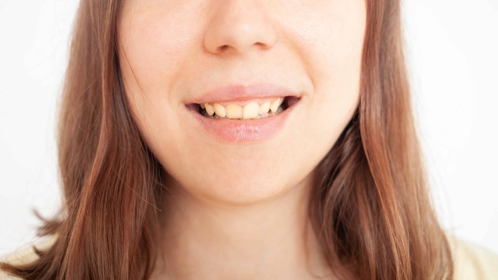 Kaip sustiprinti dantenas: greitas ir efektyvus būdas