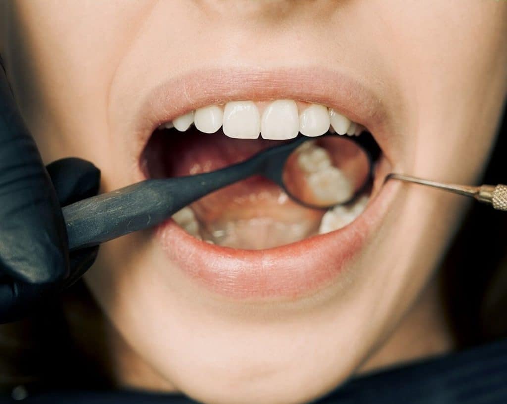 12 blogiausių maisto produktų jūsų dantims